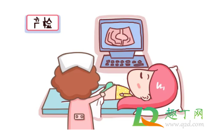 产检能往后推迟几天去么1