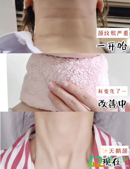 凡士林去颈纹是真的吗2