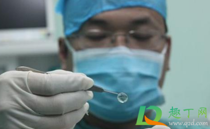国产人工角膜什么时候临床3