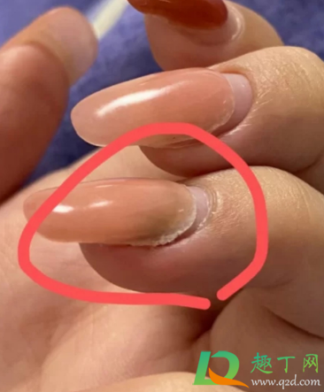延长甲能自己剪掉吗4