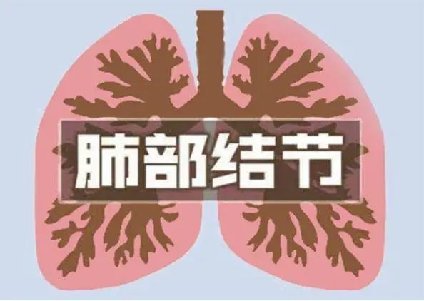 医生提醒：查出肺结节，要尽早远离这2种食物，防范结节增大