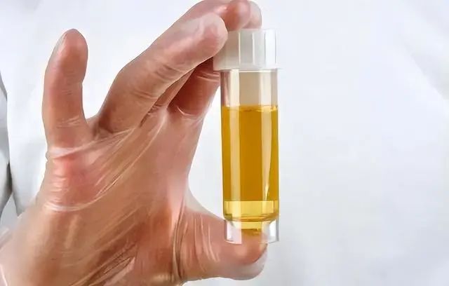 喝水后一直小便的人，与半天不去厕所的人，谁的身体更健康？