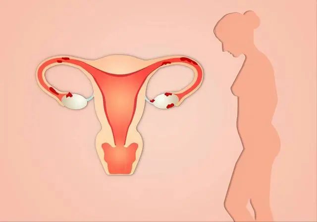 医生提醒：子宫“不欢迎”4种水果，女士要少吃，常吃这4物能暖宫