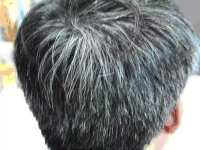长白头发的人，更不容易患癌，可信吗？日本最新研究结果公布