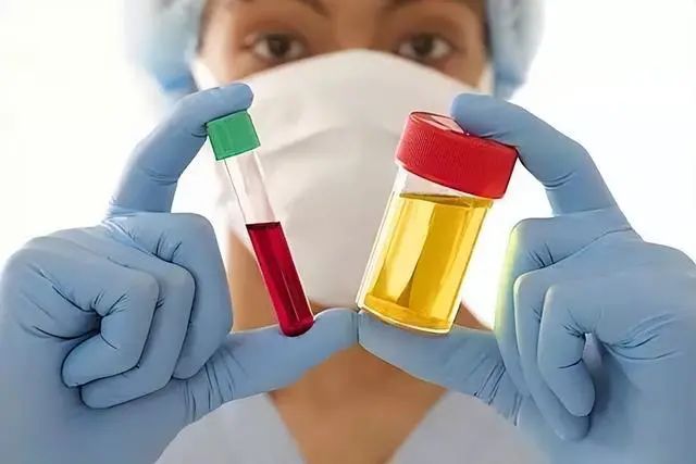 高尿酸能吃西红柿吗？忌口6种食物，帮助稳定尿酸，痛风不敢靠近