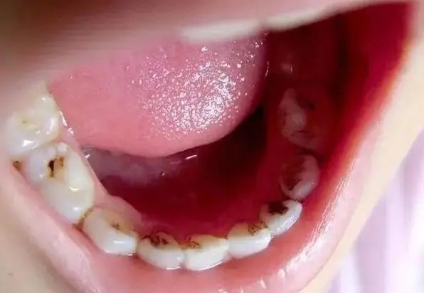 “石榴”不能随便吃？医生提醒：这5类人要注意，能不吃就不吃！