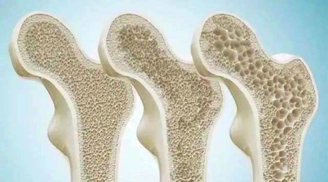 若想稳定血脂，这3种蔬菜尽量少吃，不妨来了解
