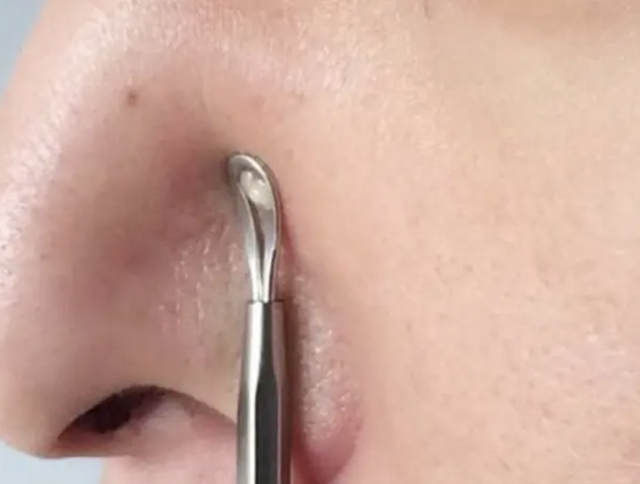 鼻子旁挤出的“白色分泌物”是什么？是螨虫吗？看完涨知识了