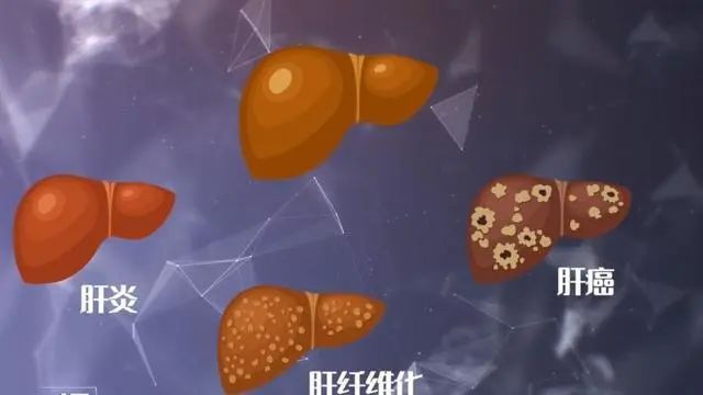 “肝病之父”吴孟超，总结60年养肝经验：做好3件事，或对肝脏好