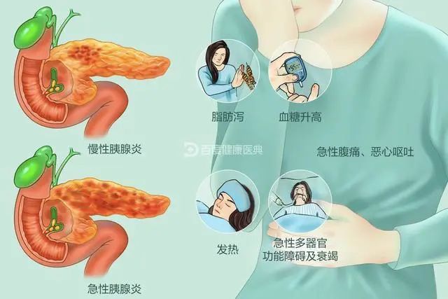 炎症会导致癌症吗？医生提醒：出现4种炎症尽量别拖，早治疗为好