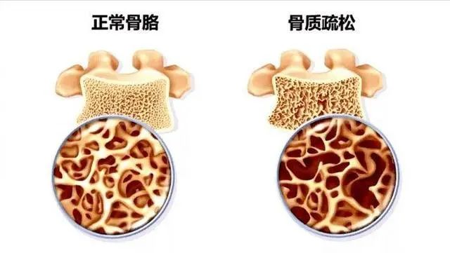 成功戒烟后，肺能恢复正常吗？提示：戒烟尽量不要超过这个岁数