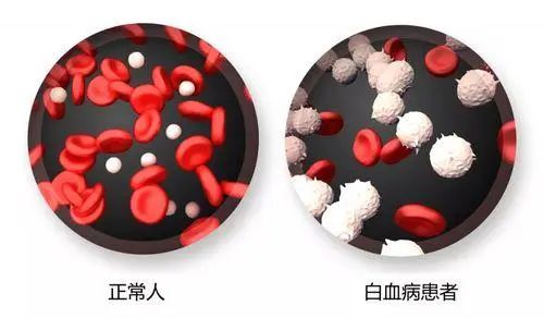 一天一片阿司匹林，身体可以承受住吗？不隐瞒，医生说出实话