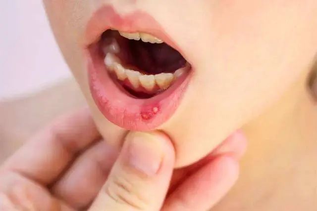长期吃辣椒和从来不吃辣椒的人相比，谁的身体更好？早了解早好