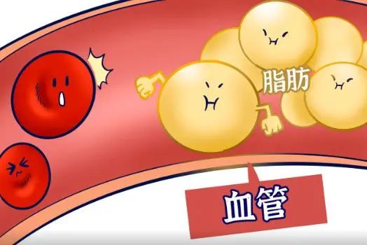 晨起是降脂“黄金期”，提醒：多吃5种早餐，血脂或会“蹭蹭降”