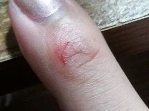 肝不好，晨起或会伴随3种情况，建议自查，希望你一个都不占