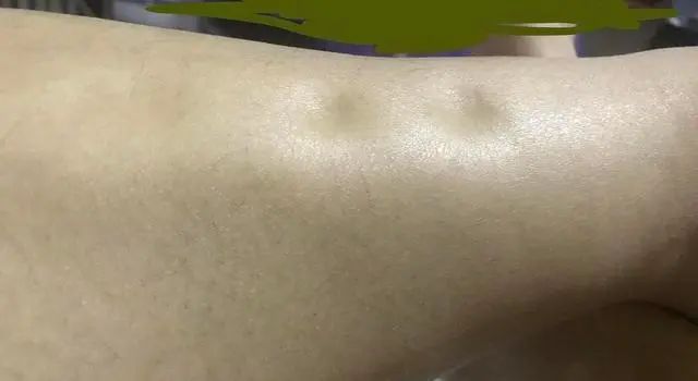 肝不好，晨起或会伴随3种情况，建议自查，希望你一个都不占