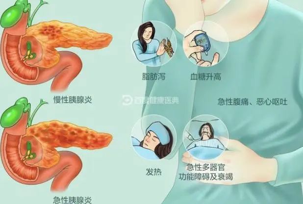 提醒：炎症或致癌症，出现6种炎症别拖，尽早治疗为好