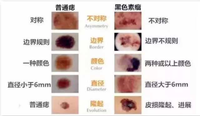 不是皮肤病，而是癌症信号？皮肤瘙痒符合哪些情况，或与癌症有关