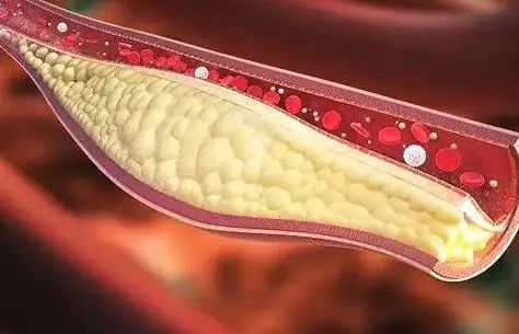 鲈鱼到底有何营养价值？医生：鲈鱼虽好，但这4种人或要少吃