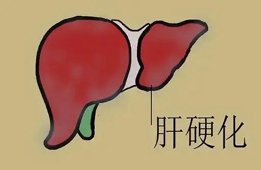 鲈鱼到底有何营养价值？医生：鲈鱼虽好，但这4种人或要少吃