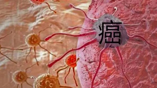 中国癌症高发，和洗洁精有关吗？医生：这3种洗涤剂，尽量不要用