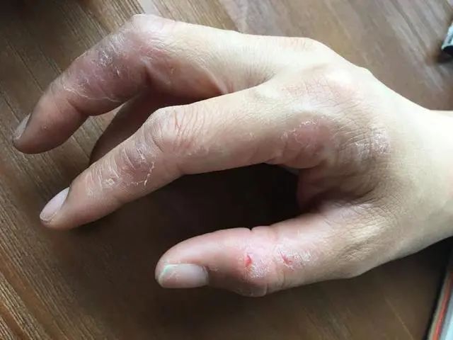 中国癌症高发，和洗洁精有关吗？医生：这3种洗涤剂，尽量不要用