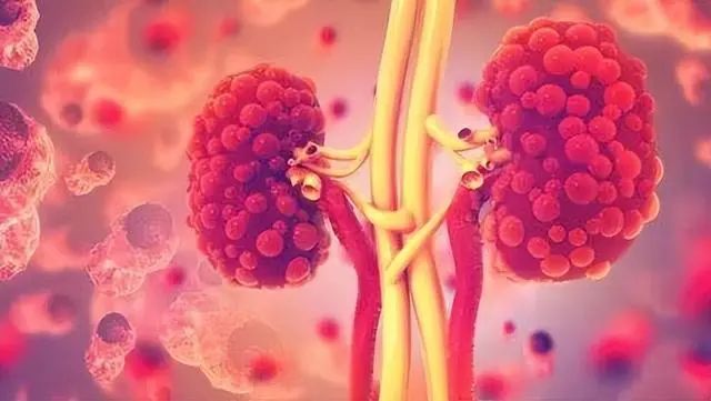 肾衰竭“刚萌芽”时，身体隐约有4个反常，别硬撑到“尿毒症”