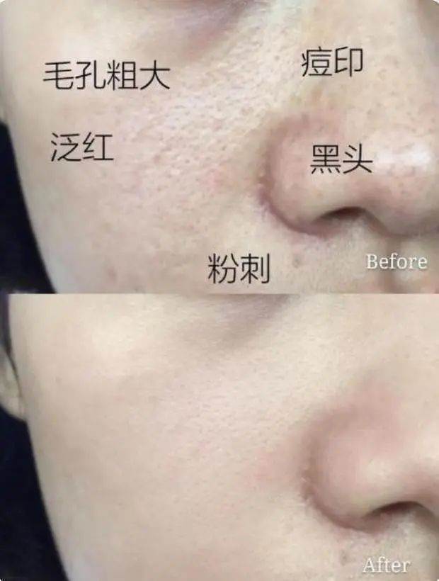 长期用“硫磺皂”洗脸洗澡，皮肤的改变有多大？现在知道也不算晚