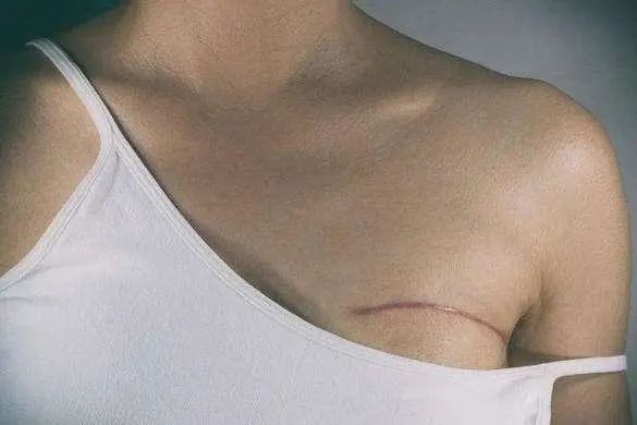 有些女性为什么容易患乳腺癌呢？医生提示：尽量避免这几种行为
