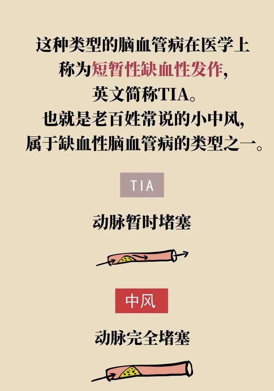 脑梗死、脑出血、脑卒中、脑中风是一回事吗？一文讲清