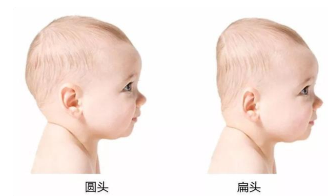 从小睡枕头和不睡枕头的孩子，长大后有啥区别？建议家长及早了解