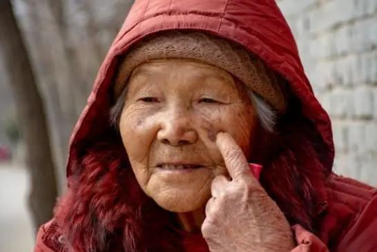 为何老人身上爱长斑？建议：50岁后远离四个习惯，或能减轻老年斑