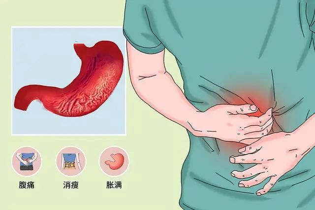 从炎症到癌症，一般需要多长时间？医生：3种炎症，尽量不要拖