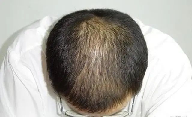 爱吃南瓜的人能收获哪些好处？提醒：好处虽多，也要注意食用禁忌