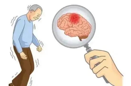 多走路可以降血脂吗？医生：多吃4种食物，或许比走路效果好