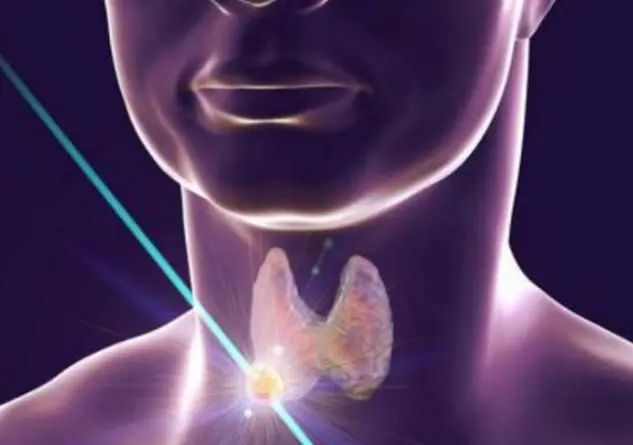 甲状腺结节患者不能吃海带吗？医生：7类食物，平时尽量少吃