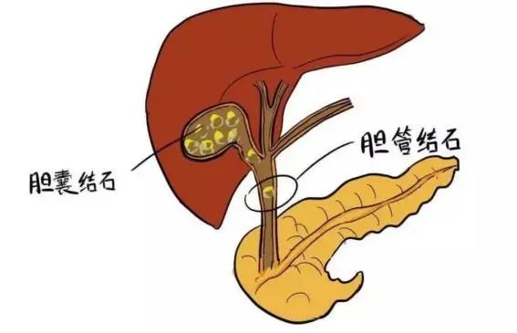 早上空腹喝水的人，比不吃早餐的人危害更大？建议早做了解
