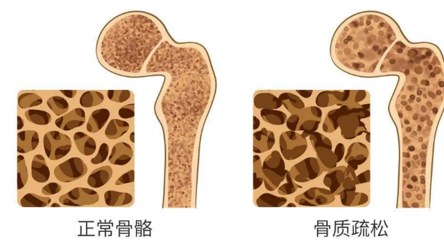长期服用六味地黄丸，会让人变年轻？这几种人，吃了没什么好处
