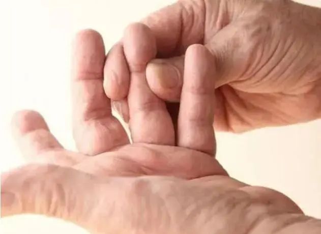 手指异常和高血压有关系吗？不妨多观察手指，是否有这3种异样