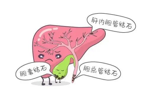 早上起床后，宁愿饿肚子，尽量少吃这6类早餐，医生：建议早了解
