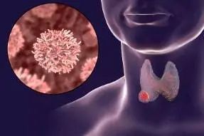 为何中国甲状腺癌人数突然“飙升”呢？医学专家说出大实话