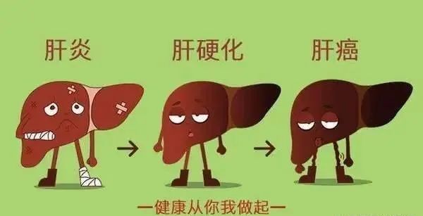 肝脏开始变硬时，身体会亮起5个“红灯”，别不当回事