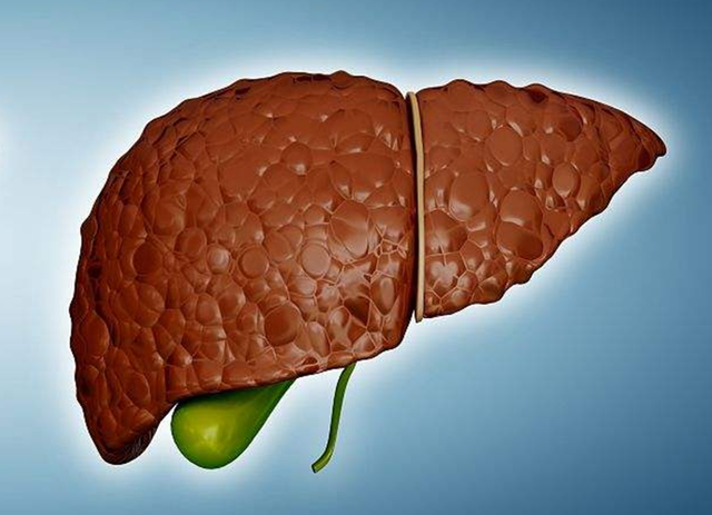 肝硬化患者平时常吃5种食物，或能使肝脏慢慢变软