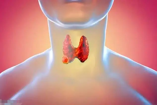 鸡蛋和牛肉，是肿瘤的“发物”？提醒：真正要少吃的是这3物