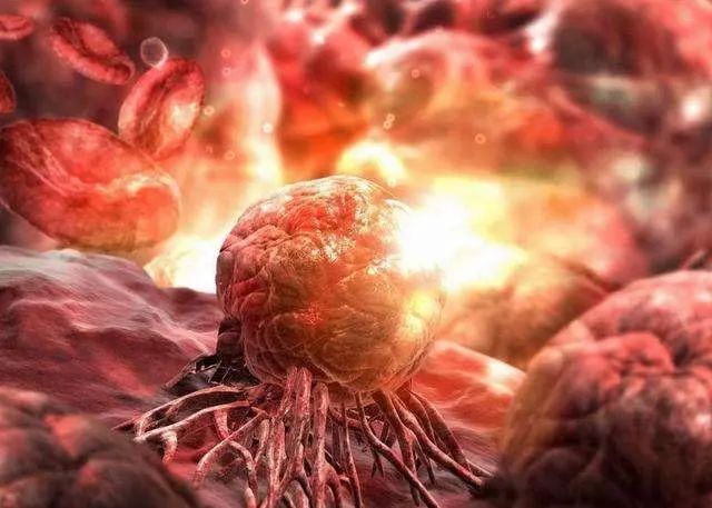癌症手术后，为什么癌细胞会转移扩散？这6个原因，请认真对待