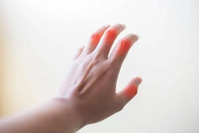 肾衰身体有什么变化？内科医生：若出现这3种情况，要保护肾了