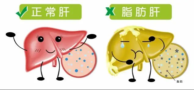 李兰娟：早晨是养肝“黄金期”，常吃三种早餐，或帮助肝脏变好