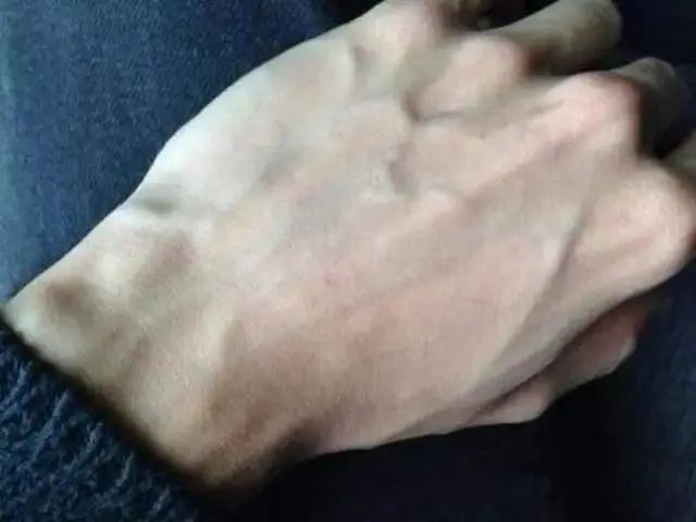 有的人手臂“青筋暴起”，有的人几乎看不到青筋，谁更健康呢？