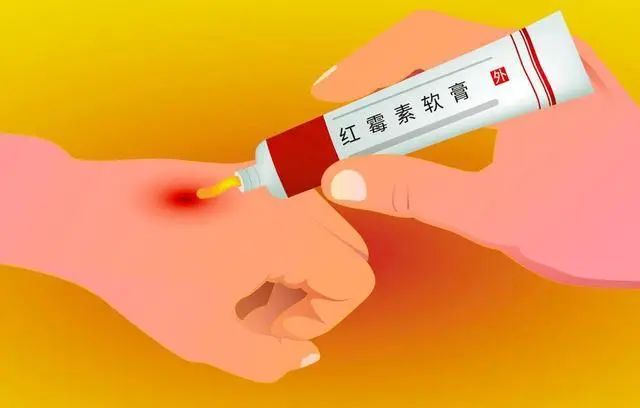 红霉素软膏，在眼部涂两下，会发生哪些变化？建议了解一下
