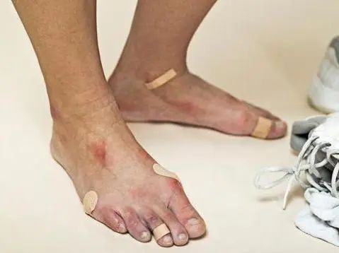 哪些食物含嘌呤较高？冬瓜排第2，第一名你经常吃吗？